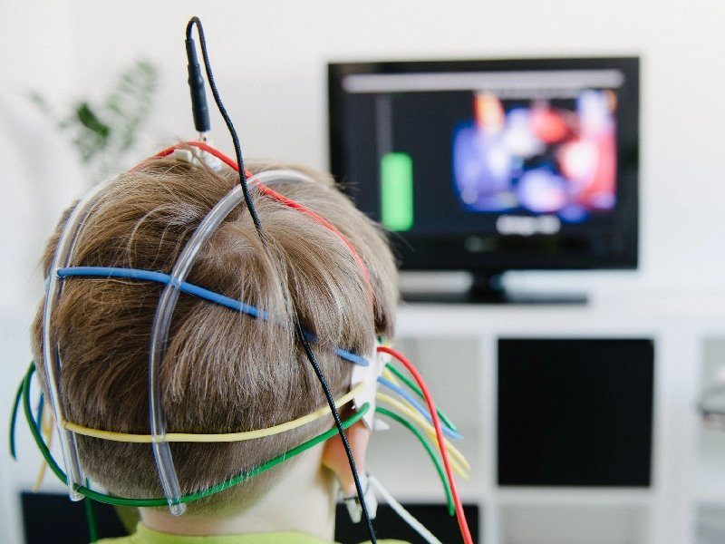 نوروفیدبک 2 نوروفیدبک, نوروفیدبک, نوروفیدبک, نوروفیدبک, نوروفیدبک تعریف نوروفیدبک