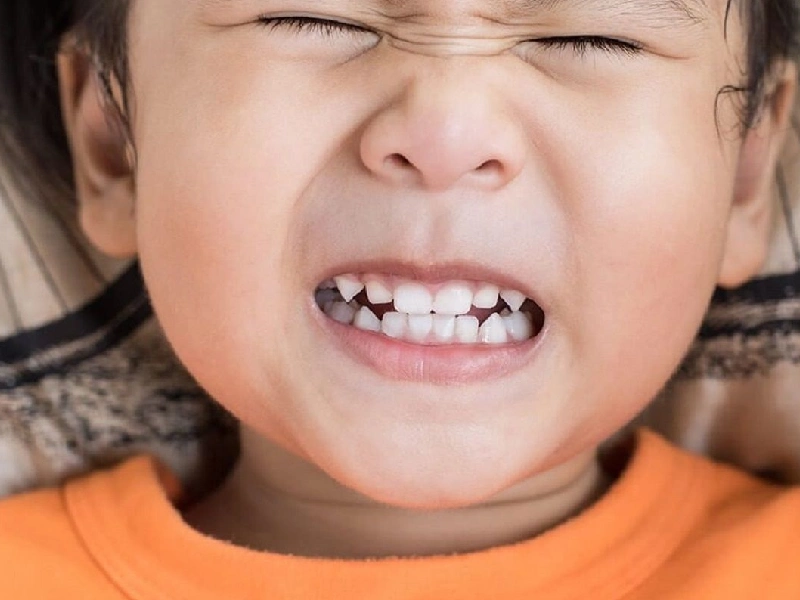 اختلالات رایج دهان و دندان دراختلال اوتیسم